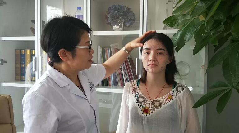 自体脂肪填充专用营养acmetea艾苛蜜靠谱吗？丽丽告诉你！