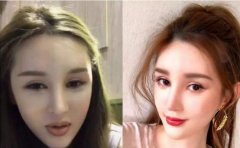 锥子脸网络红人罕见吗？锥子脸现如今满大街都是哦！ width=