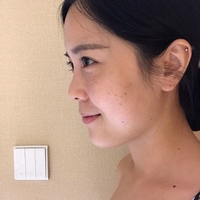 贵妇美白果如何?丑小鸭变白天鹅不是梦