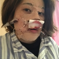 郑美善个人档案及案例曝光——郑美善原来这么牛逼!