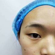 支凌翔整形技术到底如何?且听我细细道来 width=