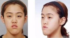许誉恩逆天改命——我们一起来见证 width=