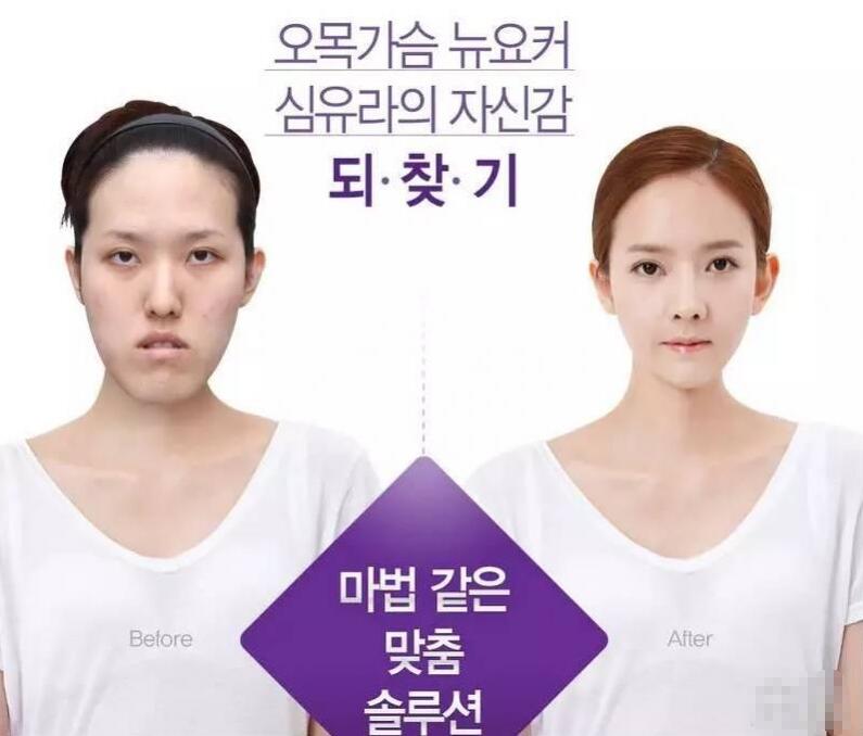 许誉恩逆天改命——我们一起来见证