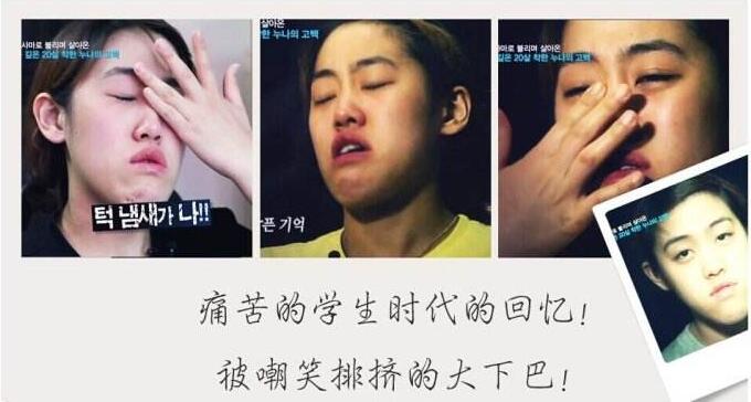 许誉恩逆天改命——我们一起来见证