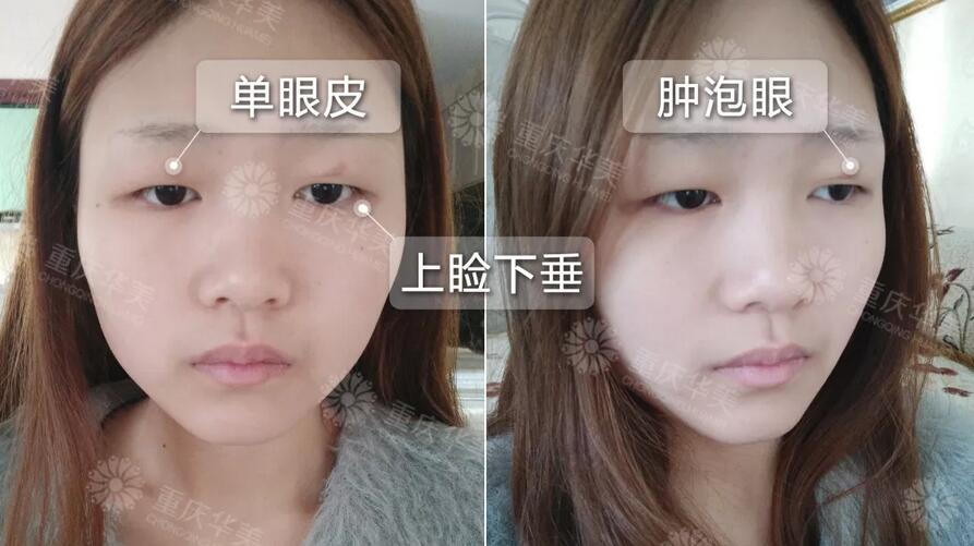 张丹峰为继子庆生？！  洪xin神仙颜值简直完爆小三好吗！