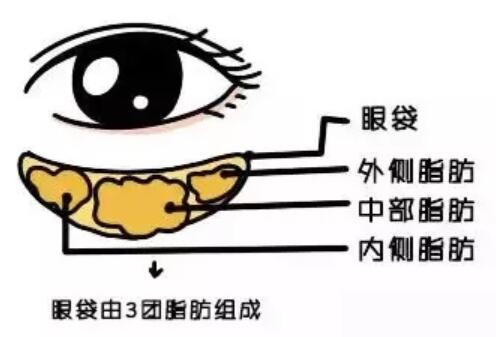 雅皙祛眼袋有吗？真人真事儿可以说明哟！