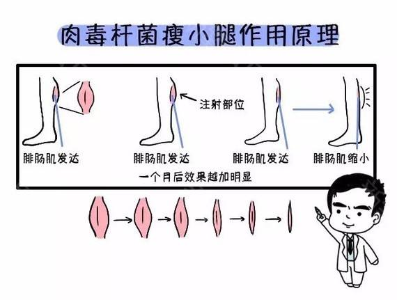 就想问一下现在注射瘦脸注射瘦腿的价格是多少?