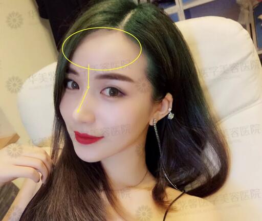 塌鼻子的救星来辣|华美紫馨隆鼻3折，你不安排下吗？！