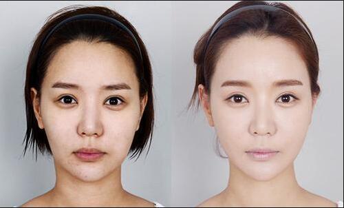 打美白需要多少钱?贵吗?