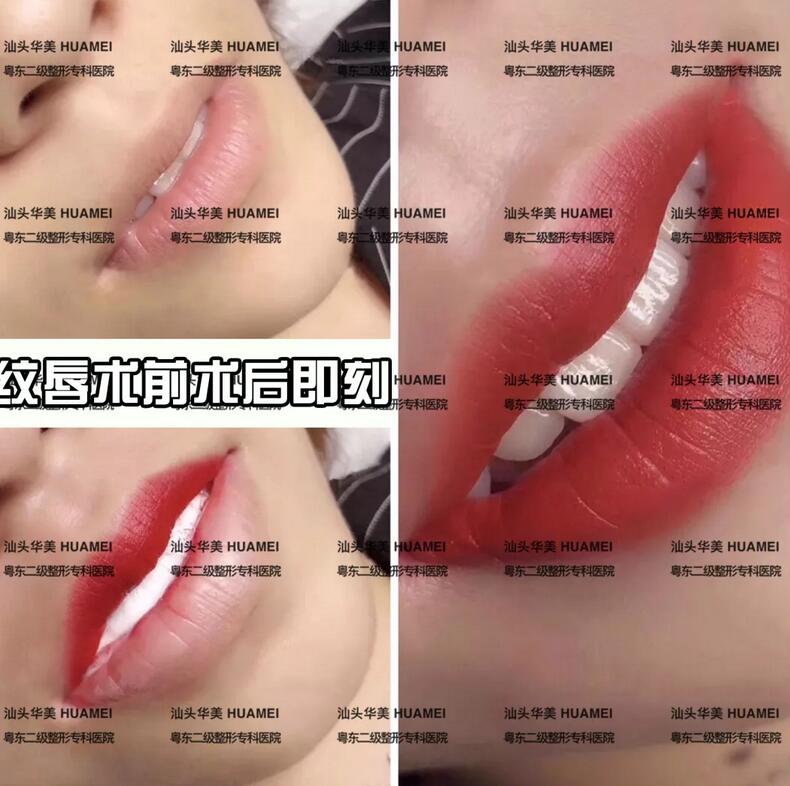 唇红齿白专场丨纹唇、牙齿美白福利来了，放送免费体验名额！