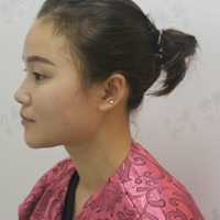 郭文婧医生的技术水平如何?郑州集美医院真实案例为你解答