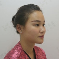 郭文婧医生的技术水平如何?郑州集美医院真实案例为你解答