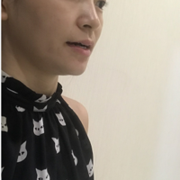 黄剑美医生的技术水平真与她的容貌成正比吗?真实案例奉上