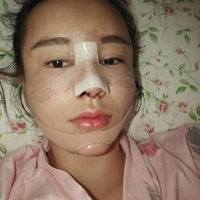 黄剑美医生的技术水平真与她的容貌成正比吗?真实案例奉上