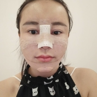 黄剑美医生的技术水平真与她的容貌成正比吗?真实案例奉上