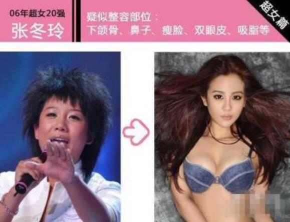 张冬玲整容前后对比，麻雀焉能变凤凰