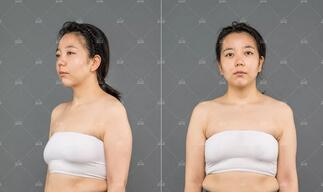 0元丰胸|重庆美莱&傲诺拉，12星座维密胸模免费招募~