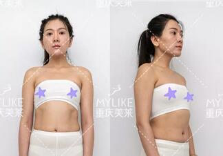 0元丰胸|重庆美莱&傲诺拉，12星座维密胸模免费招募~
