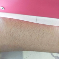 shr冰点脱毛价格贵吗?来自小姐姐的真情诉说