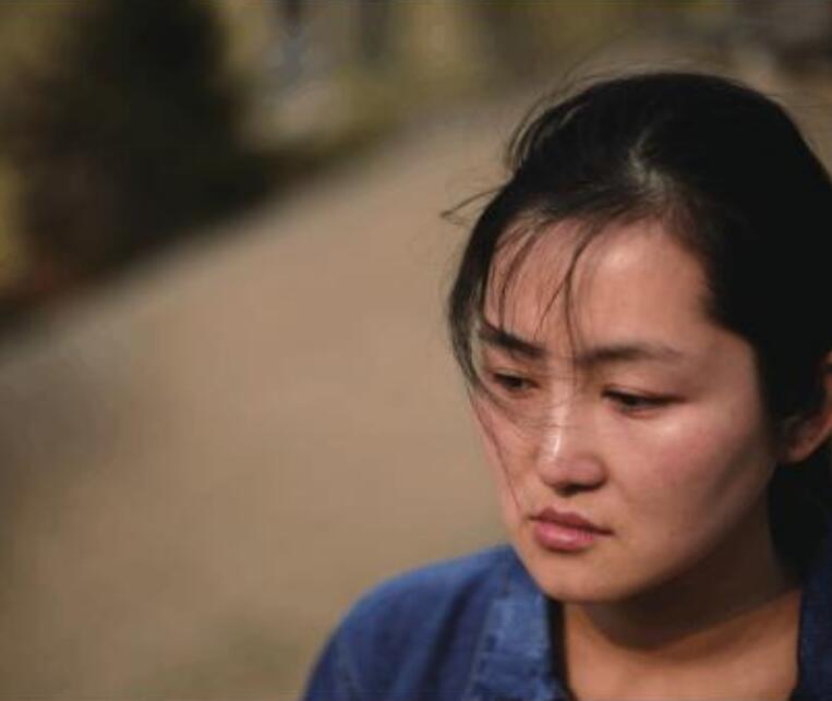 靳魏坤整形失败后，坎坷的维权之路分享