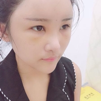 蒋亚楠技术水平怎么样?小姐姐真实案例分享