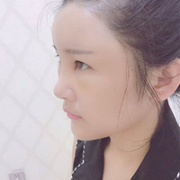 蒋亚楠技术水平怎么样?小姐姐真实案例分享