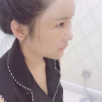 蒋亚楠技术水平怎么样?小姐姐真实案例分享