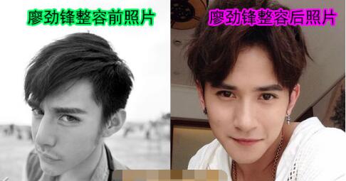 轰叔整容前照片流出，盘点一下改变之处都有哪些?