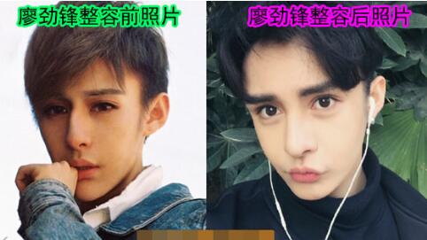 轰叔整容前照片流出，盘点一下改变之处都有哪些?