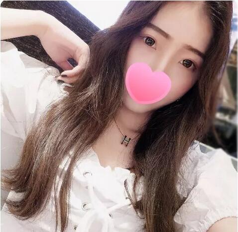 上海薇琳医美张怀军割双眼皮技术好吗？案例就是******见证！