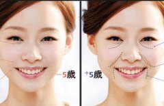 广州海峡整形美容：法令纹误打奥美定后该怎么办？ width=