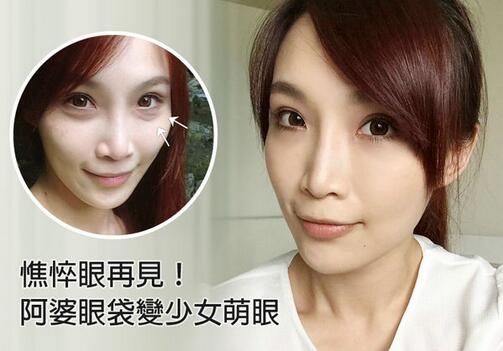 撒娇肉是什么？如何拥有撒娇肉？