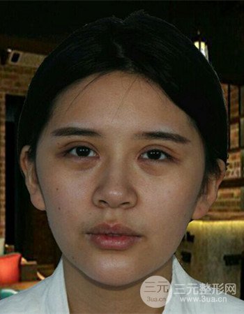 仁雁光乳化祛眼袋究竟靠不靠谱？我用亲身经历告诉你！
