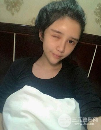 仁雁光乳化祛眼袋究竟靠不靠谱？我用亲身经历告诉你！