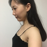 伊美尔长岛整形医院隆胸技术如何，阜凌120天恢复全过程直播~~