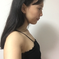 伊美尔长岛整形医院隆胸技术如何，阜凌120天恢复全过程直播~~