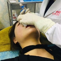 金日炫注射美容果如何?注射前后对比图及案例分享