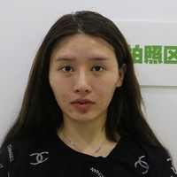 赵延勇擅长什么项目?听说双眼皮技术还不错哦