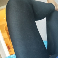 昆明大华整形怎么样?做吸脂果好吗?