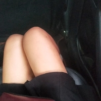 昆明大华整形怎么样?做吸脂果好吗?