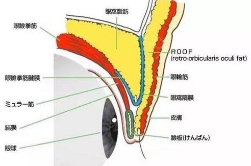 像大幂幂这种双眼皮都会成为多重睑？？