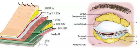 像大幂幂这种双眼皮都会成为多重睑？？