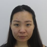 去颊脂垫有副作用吗?行家为了做较的解答 width=