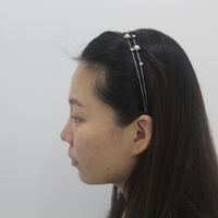 去颊脂垫有副作用吗?行家为了做较的解答