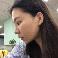 去颊脂垫有副作用吗?行家为了做较的解答