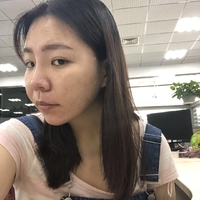 去颊脂垫有副作用吗?行家为了做较的解答