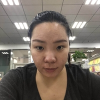去颊脂垫有副作用吗?行家为了做较的解答