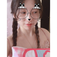 郑州悦美整形闫海廷丰胸全程分享~看其极大变化~~