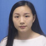 光乳化去眼袋23天对比图：眼袋不是卧蚕该去就去 width=