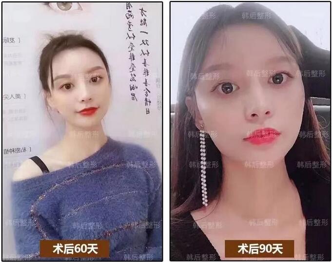 韩后官网：为什么你年纪轻轻却显老20岁？ 原来是因为这个部位！